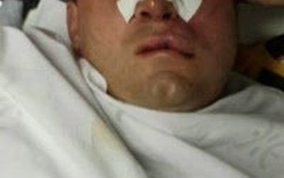 Soldado acusado de ferir duas pessoas no Réveillon de Camburi e que entrou na Polícia Militar graças a decisão judicial se defende: “Atirei para me defender das agressões”