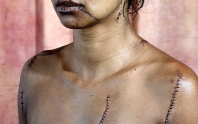 Mulher retalhada com golpes de navalha em boate de Vila Velha: Soldado é indiciado em IPM por tentativa de homicídio e outros seis militares pela transgressão da disciplina