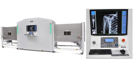 Novo Raio-X do DML vai aumentar o poder de investigação de assassinatos no Espírito Santo